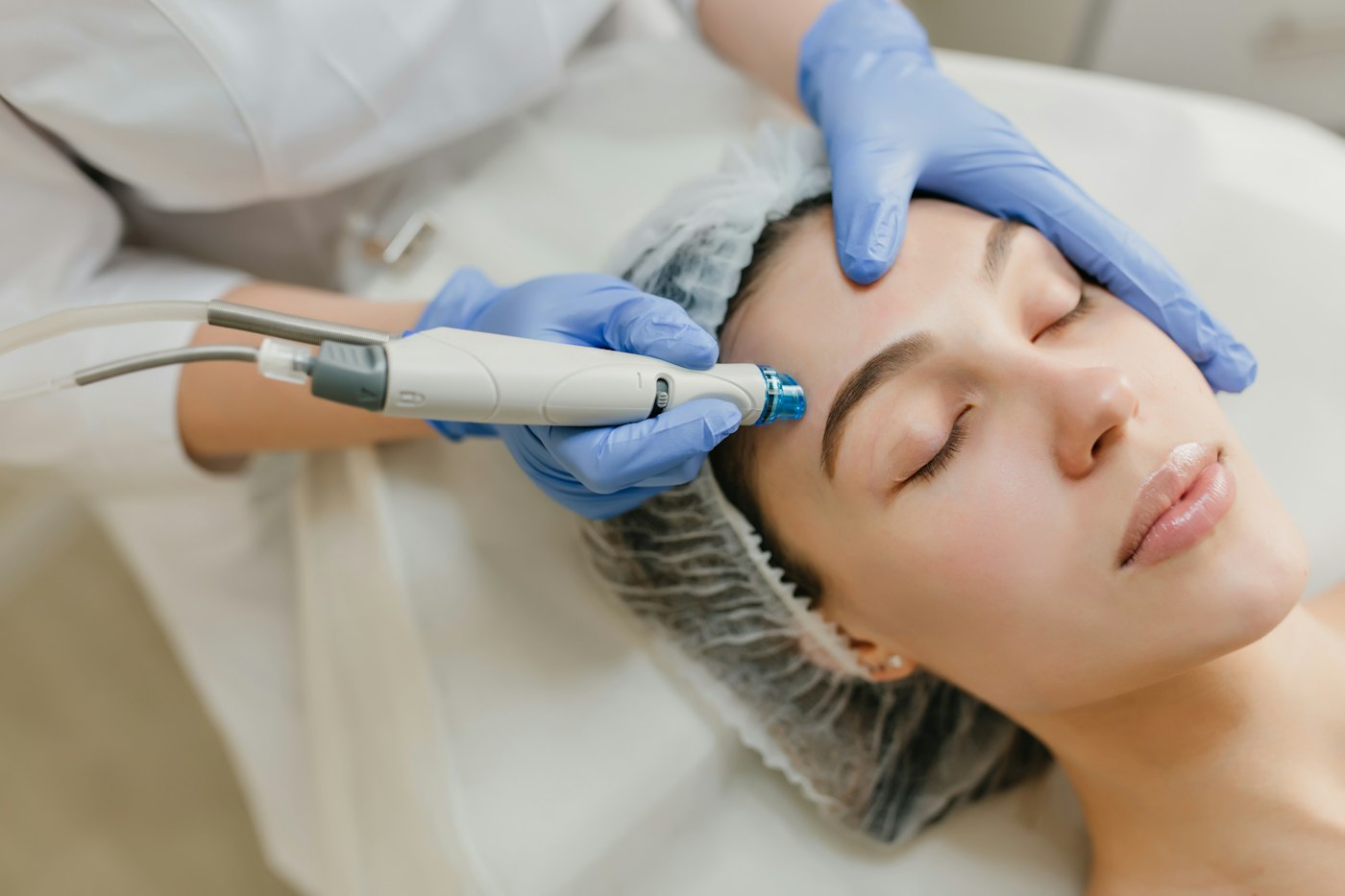 Procedură dermatologică realizată în cabinet